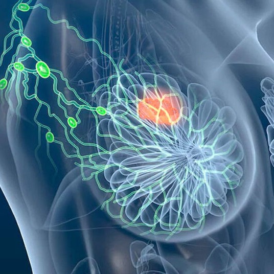Cirurgia Radioguiada Núcleos Medicina Nuclear